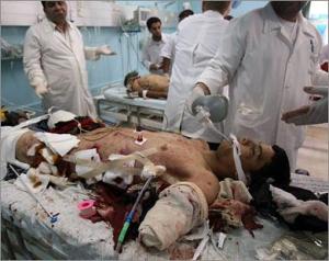 Anak Gaza meregang maut setelah serangan brutal darat, laut, udara pasukan Israel, Januari 2009.